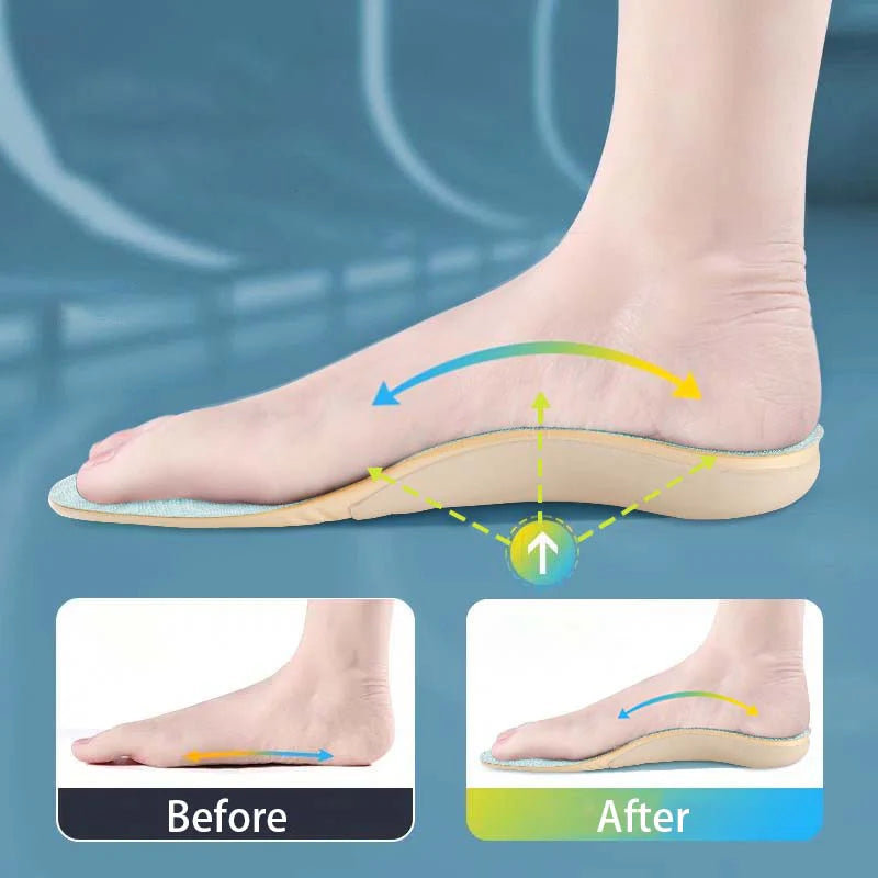 Insoles for Flat Feet and Arch Support